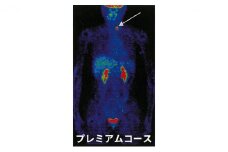 P1 プレミアムコース PET-CT 骨盤腔MR 超音波検査 腫瘍マーカー がん チェック 子宮 卵巣 膀胱 前立腺 腹部 すい臓 腎臓 消化管 悪性リンパ腫 スクリーニング検査 [№5704-0596]