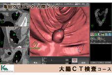 【亀田クリニック人間ドック】大腸CT検査コース　１名様（単独）　[0130-0001]