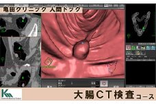 【亀田クリニック人間ドック】大腸CT検査コース　１名様（単独）　[0130-0001]