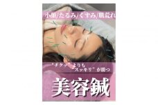 美容鍼　（１回）