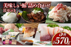 【7営業日以内発送】美味しい鯨5種詰め合わせBセット (大和煮缶詰・オバ鯨・ベーコンスライス・湯かけくじら・さえずりスライス) 合計570g ／ 鯨 クジラ肉 鯨料理 セット 珍味