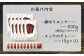 鮮馬刺し赤身ユッケ10個セット 約500g 馬肉 50g×10
